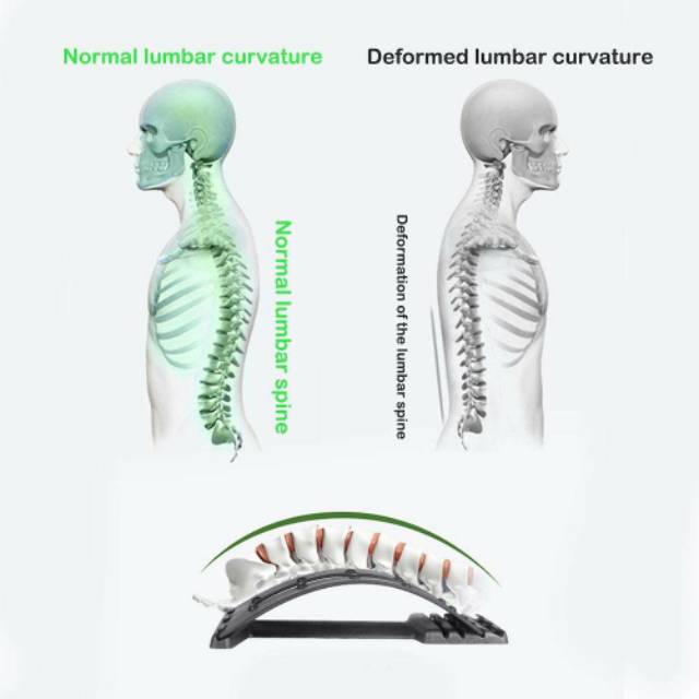 BACKCARE Alat Terapi Pinggang Punggung Belakang &amp; Syaraf Kejepit