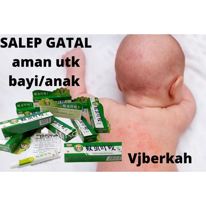 SALEP/CRIM ANAK DAN BAYI PALING AMPUH MENGHILANGKAN GATAL PADA KULIT/BAKAS GIGITAN NYAMUK RUAM