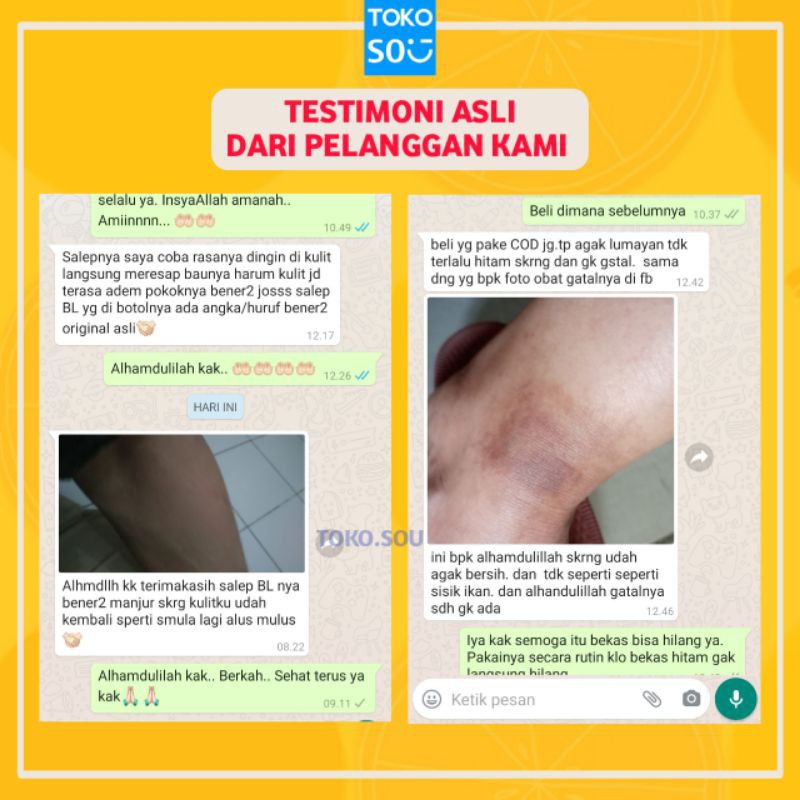 TERLARIS !! - Salep BL Ampuh ASLI Original 100% | Obat Gatal | Salep Kulit Gatal | Obat Eksim Exim Panu Jamur Kudis Kurap