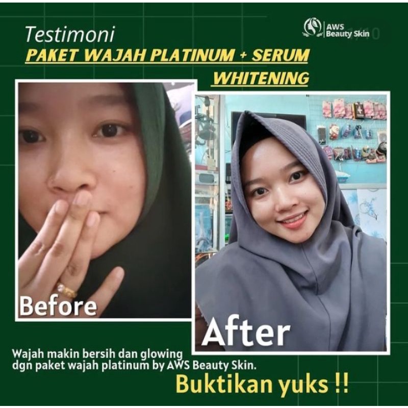 Paket perawatan wajah berkwalitas super.-5