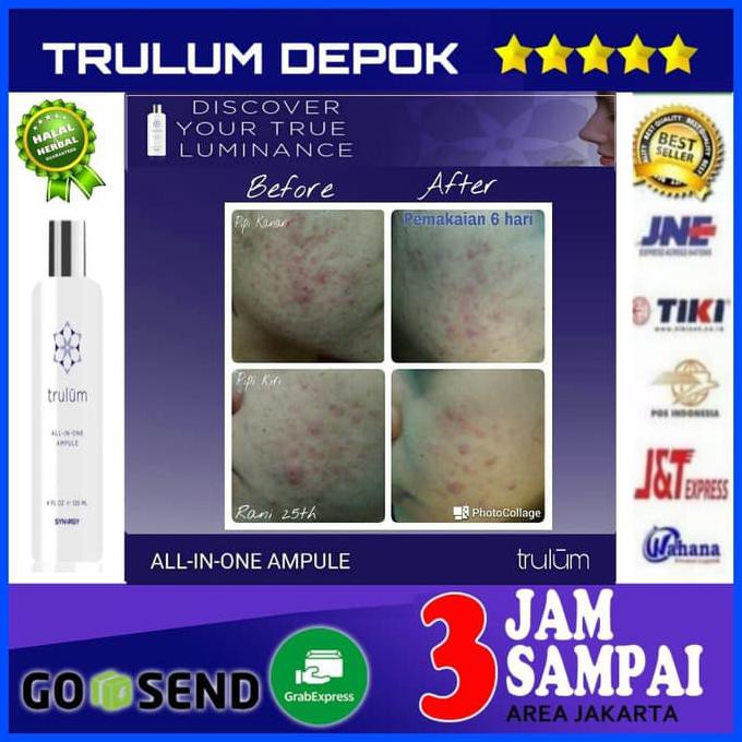 

Pengganti Cream Jerawat Aman | Perawatan Wajah Herbal Alami