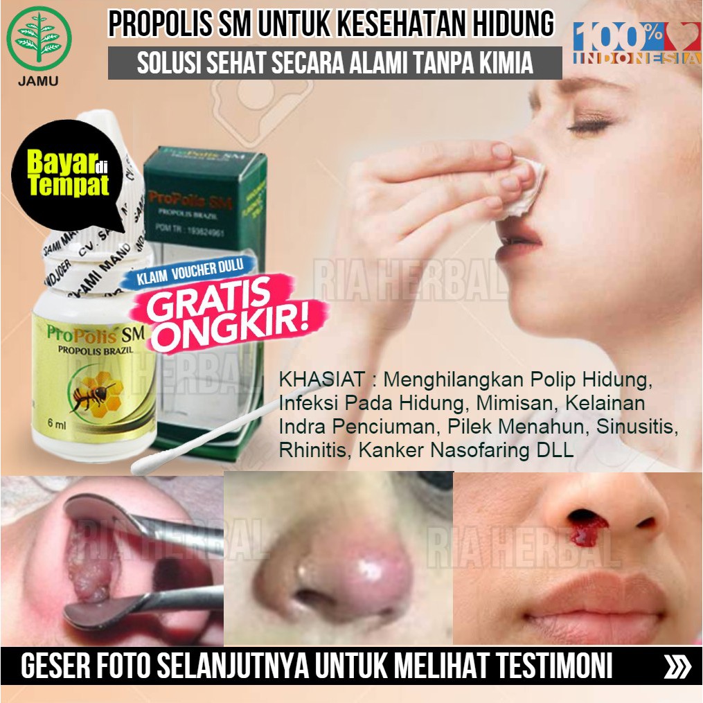 Obat Hidung Tersumbat Daging Jadi Perontok Polip Anosmia Indra Penciuman Hilang Terhalang Asli Shopee Indonesia