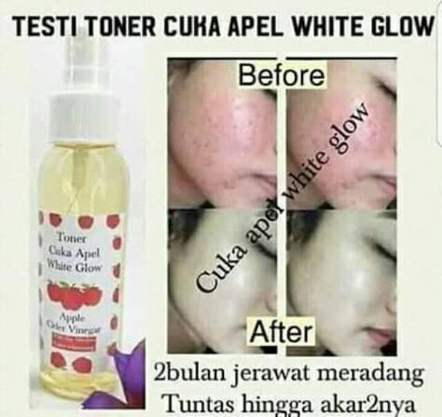 Toner Cuka Apel White Glow Toner Cuka Apel Indonesia