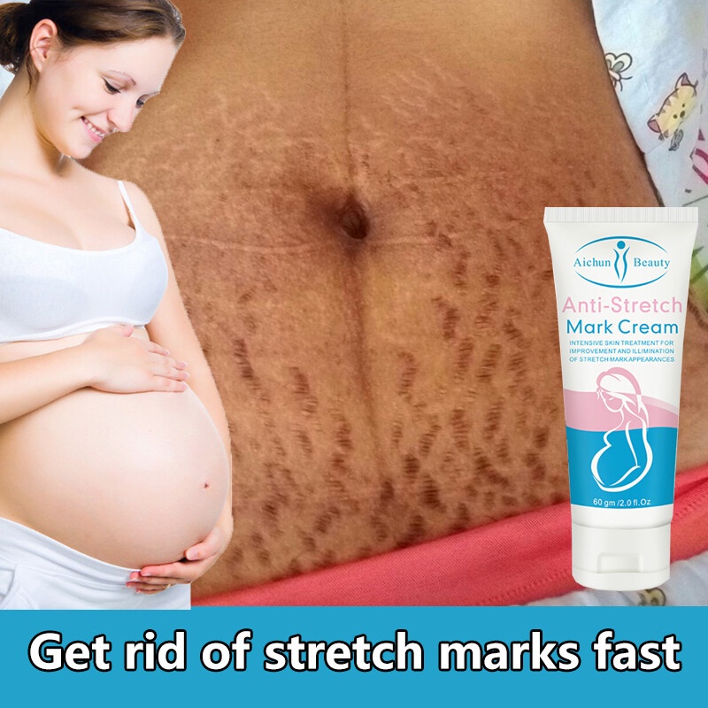 Strechmark cream Penghilang strechmark Penghilang bekas luka Salep penghilang bekas luka Menghilangkan bekas luka yang aman dan efektif untuk ibu hamil