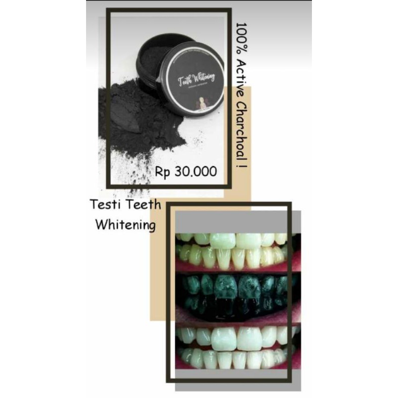 Teeth Whitening