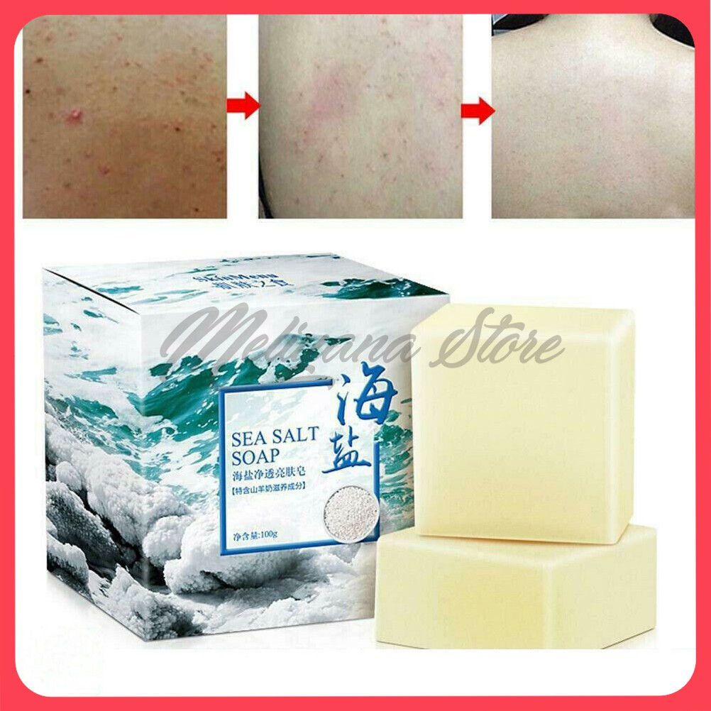 ORIGINAL Sea Salt Soap Sabun Jerawat Menghilangkan Jerawat Punggung Dan Muka