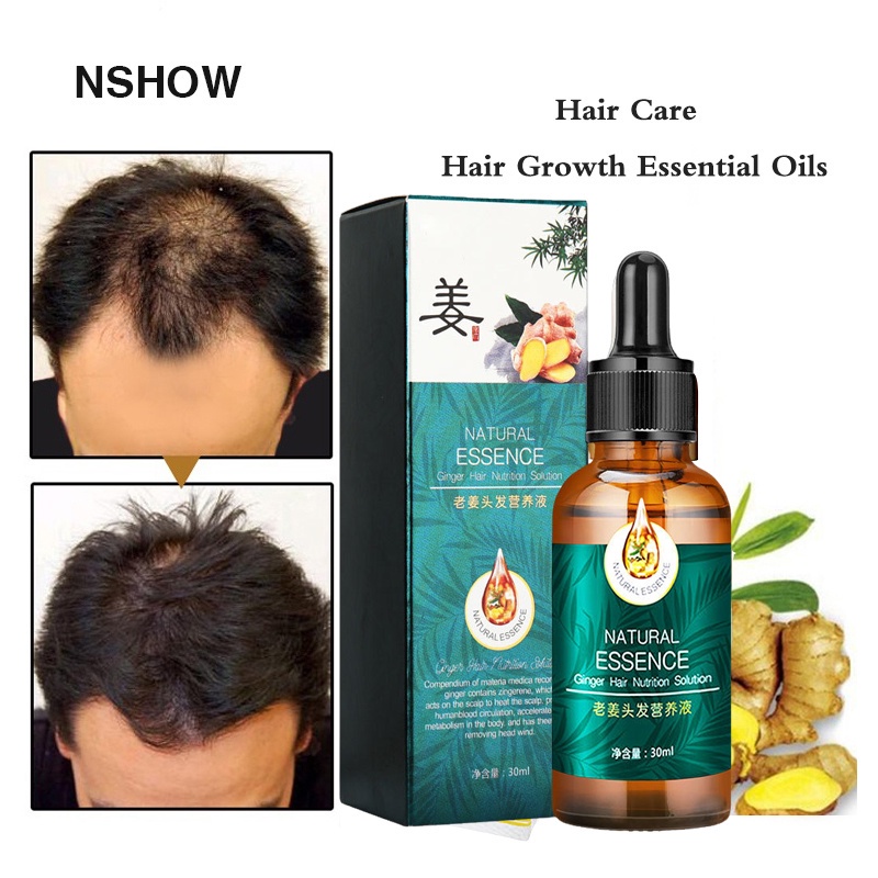 Minyak esensial perawatan rambut/ Anti-Hair Loss Serum/ Natural Essence Ginger Hair Tonic/ Toner Rambut Ekstrak Sari Jahe 30 ML