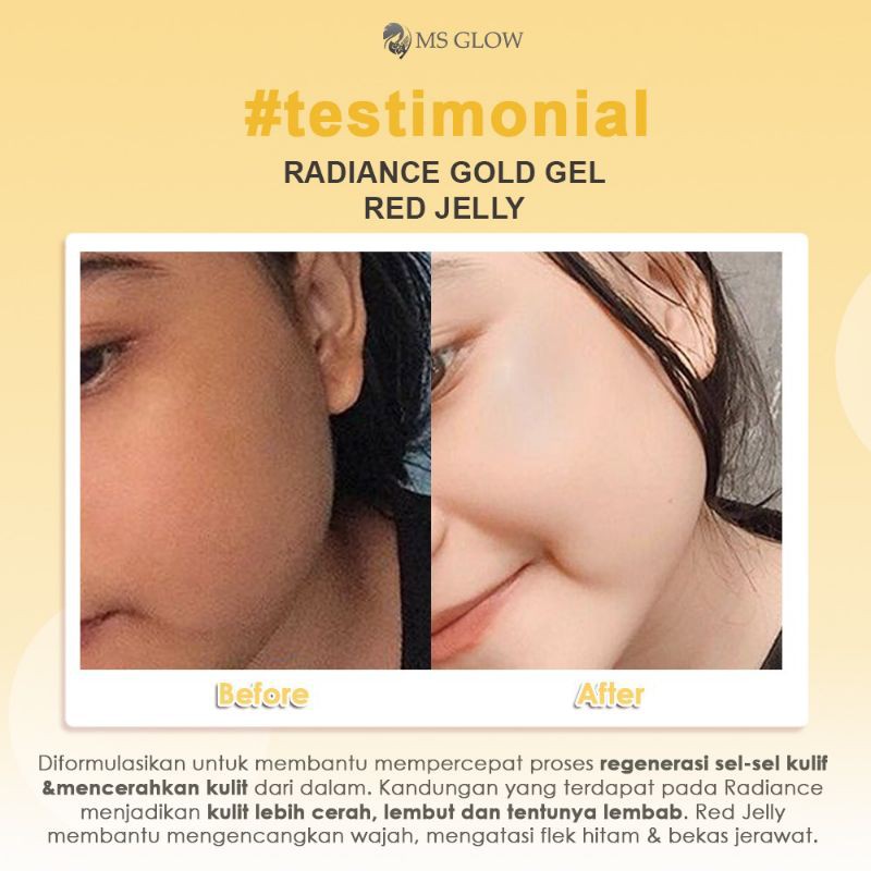 Radiance Gold Gel MS Glow / Mempercepat putih wajah / Gold Gel / Produk Terlaris / Original