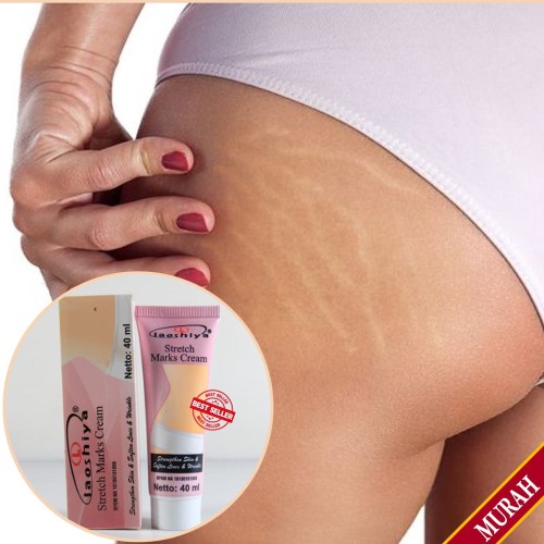 LAOSHIYA Stretchmark Cream / Penghilang Stretch Mark / Selulit Ampuh Original