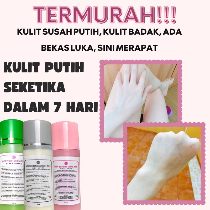 HB Whitening Melip | HB Pemutih | HB dosting | Body lotion Whitening | HB Ultimate | HB Express | HB