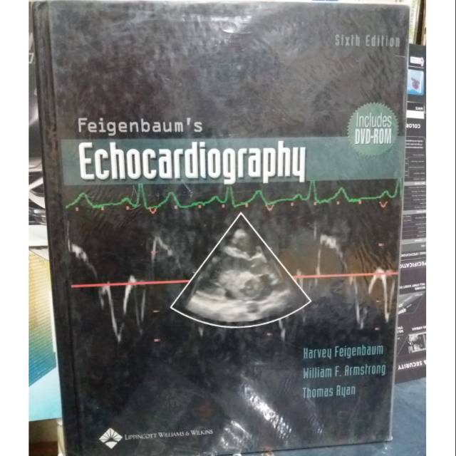 Feigenbaums ECHOCARDIOGRAPHY