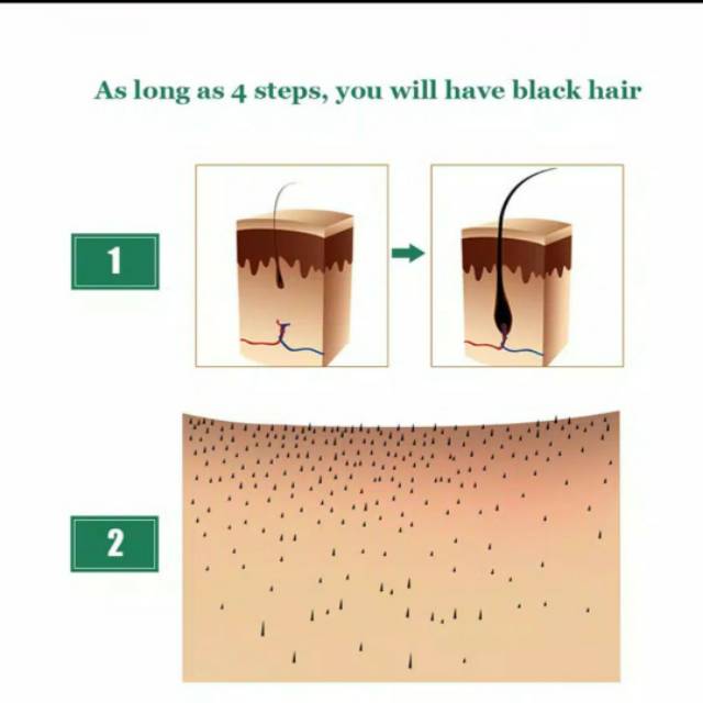 Cairan Essence Penumbuh Rambut Anti Rontok-2