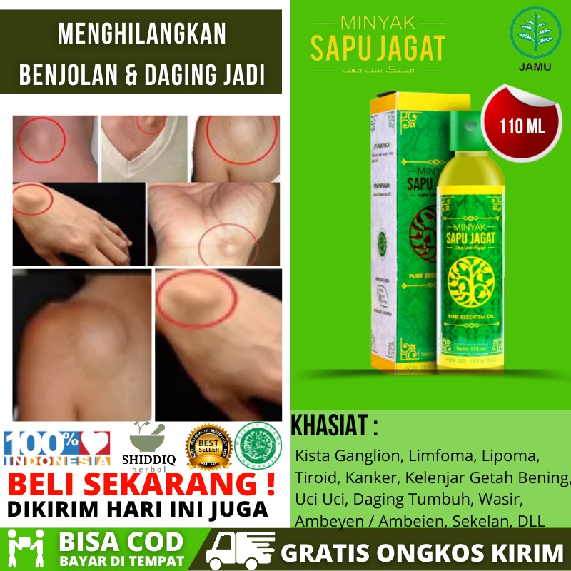 Sapu Jagat Original Minyak Oles Benjolan Obat Benjolan Minyak Qahira Pengempis, Penghancur, Penghila