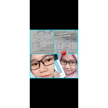 KACAMATA ION NATURAWORLD