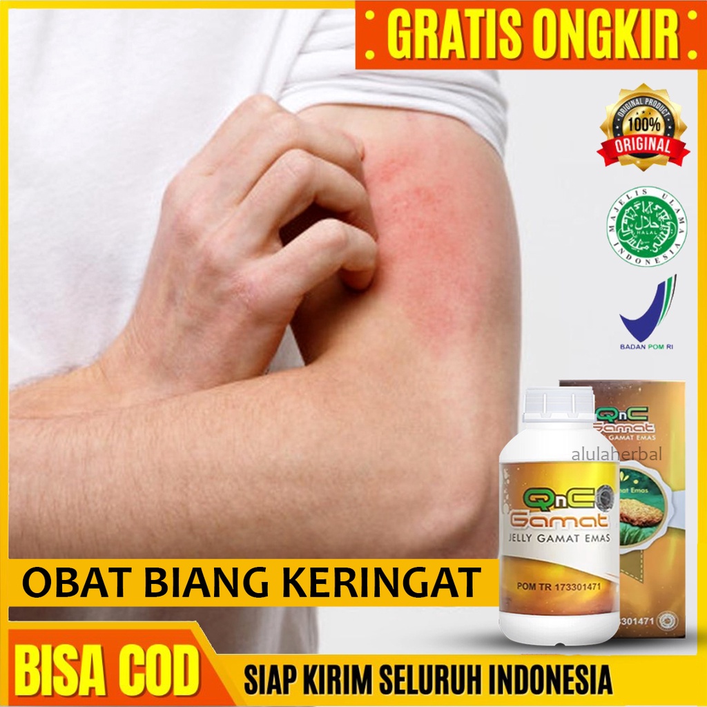 Jual Obat Biang Keringat Ruam Merah Dan Gatal Di Kulit Bintil Bintil Kemerahan Di Kulit Miliaria 5824