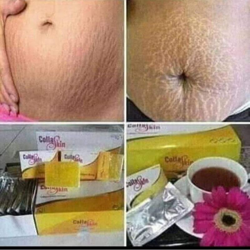 

Skincare collaskin murmer