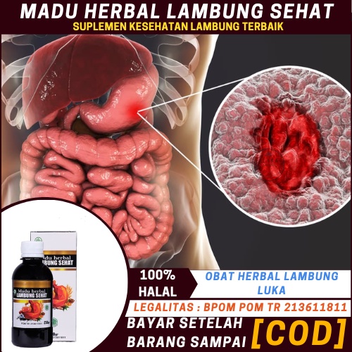 Obat Herbal Luka Lambung, Sakit Maag Akibat Luka Lambung, Radang Lambung, Nyeri Lambung Akut, Obat L