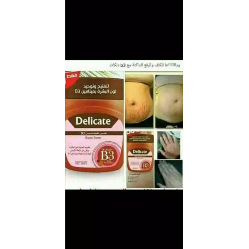 MY WAY Delicate B3 cream penghilang strectmart dan flek hitam BPOM, aman halal bumil busui 100% original