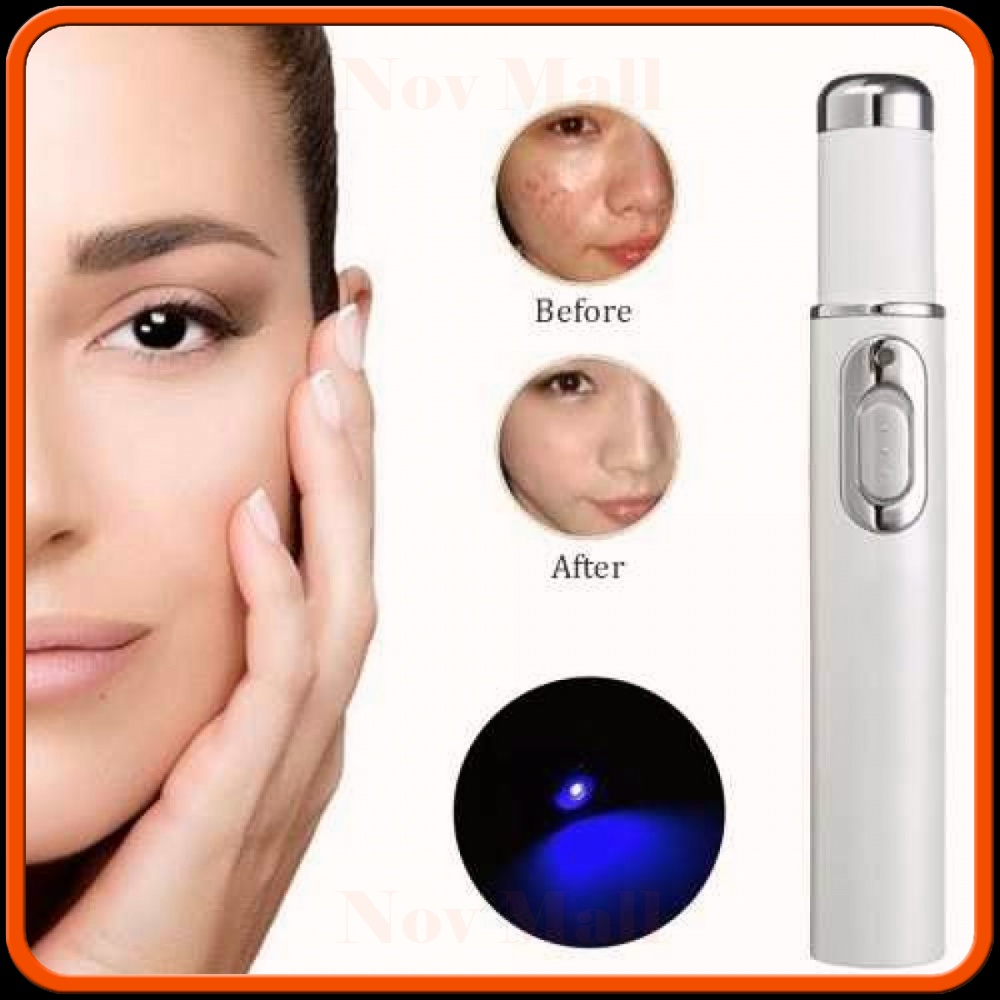 Pen LED Biru Laser Penghilang Jerawat Acne Treatment - KD-7910