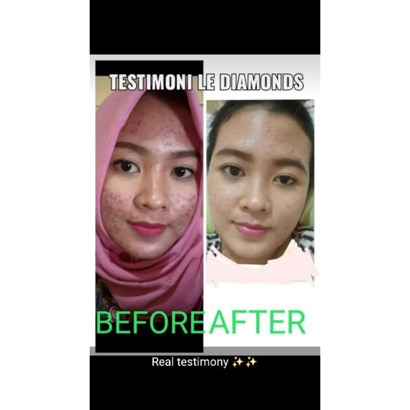 Le Diamonds Herbal Soap Propolis