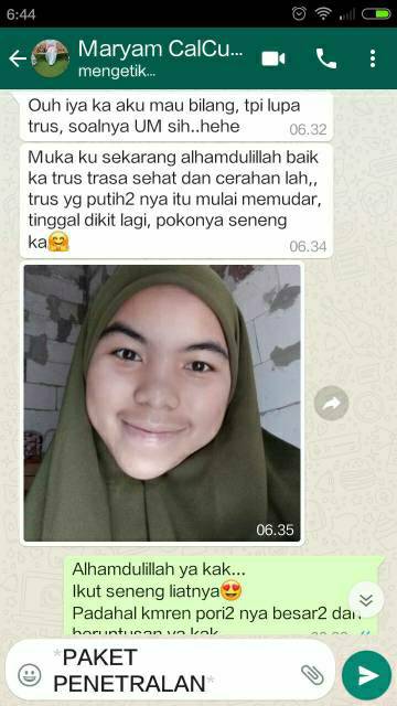 testimoni halwey skincare