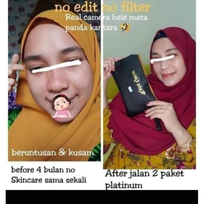 PAKET SKINCARE BPOM (COD) RATU GLOW PLATINUM ORI / PAKET EKONOMIS ORI