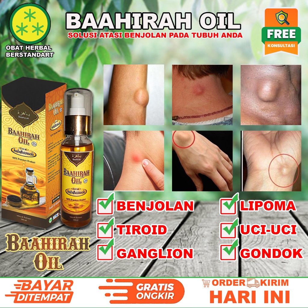 [PROMO IDUL ADHA 1 PAKET]- BENJOLAN GONDOK - OBAT BENJOLAN LIPOMA - KANKER - UCI UCI -