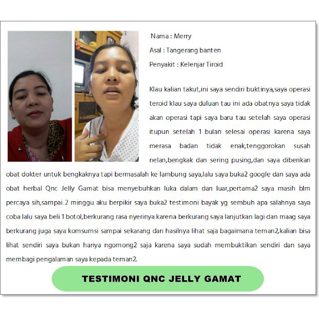 Obat Gondok Beracun Di Leher Kelenjar Tiroid Herbal Qnc Jelly Gamat 300 Ml Aman Untuk Anak Dan Dewasa 100% Original