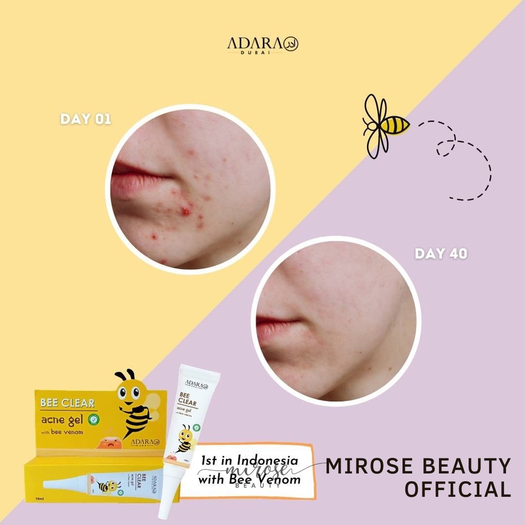 ADARA -  Bee Clear Acne Gel &amp; Bee Clear Extra Formula