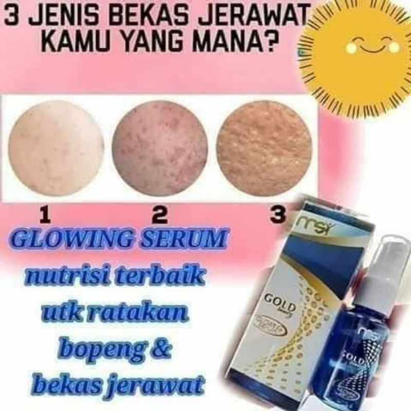 PAKET HEMAT FLEK HITAM PAKET MSI FLEK HITAM MURAH SKINCARE MURAH FLEK HITAM