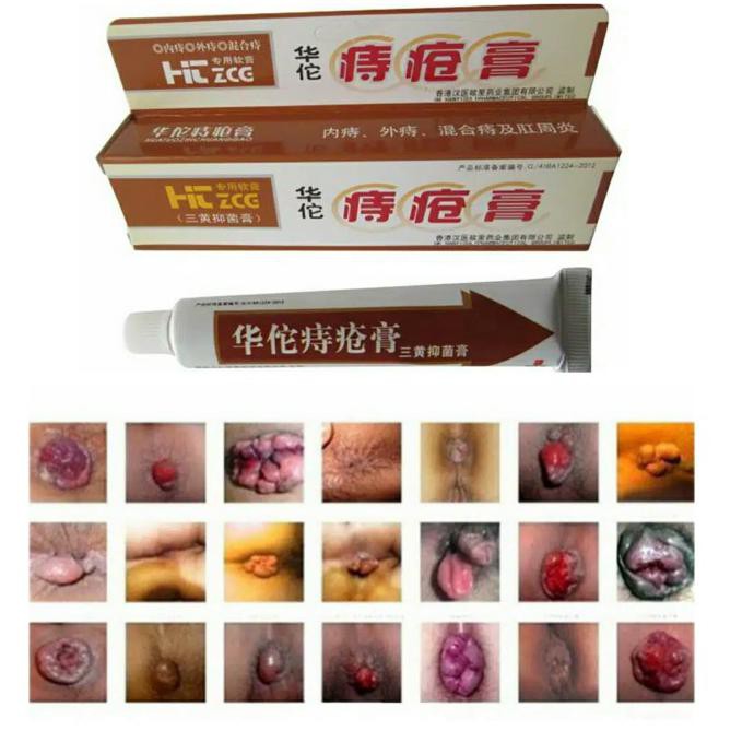 Huatuo Hemorrhoid Cream Obat Wasir dan Ambeien Manjur