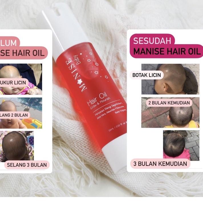 Diskon BBSYS GONDRONG HANYA 1 MINGGU Manise Hair Oil baby minyak rambut kemiri lotion candle nut fo