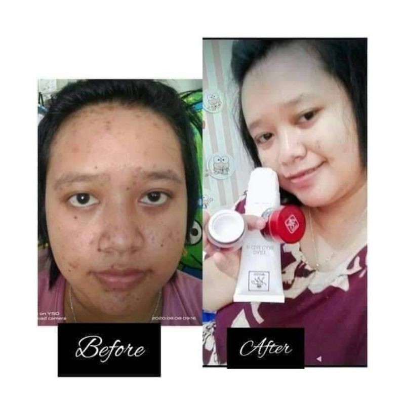 PAKET HEMAT GLOWING ORI RK SKINCARE VIRAL  BEBAS FLEK HITAM DAN COMEDO
