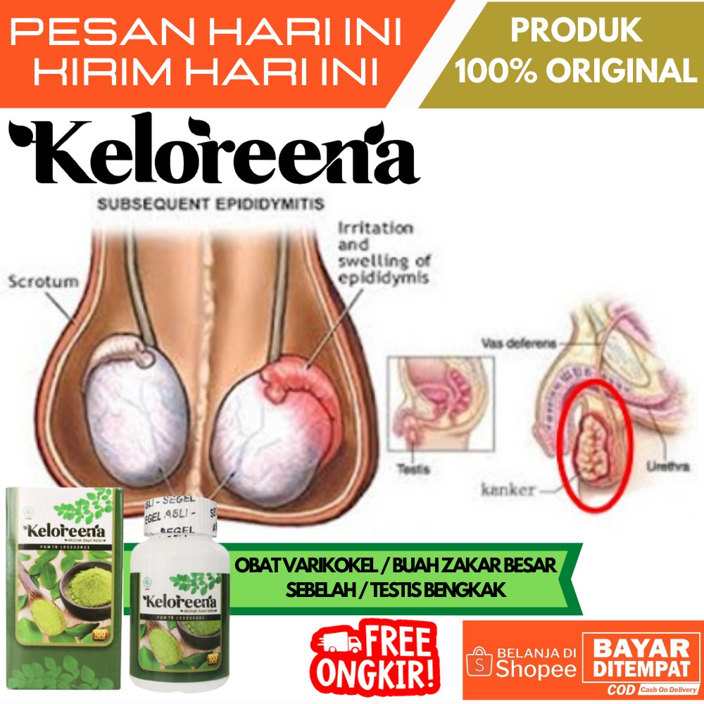 Obat Testis Bengkak / Testis Bengkak Sebelah / Obat Testis Bengkak di Apotik / Obat Varikokel / Hern