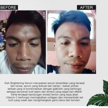 ♘ Serum Wajah | Serum Aish | Serum Aish Brightening | Serum Pencerah Wajah ☀