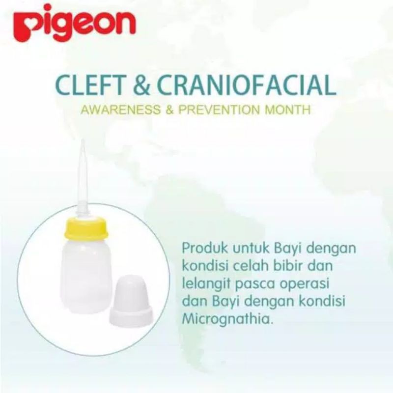 Pigeon Botol Pipet untuk Bayi Bibir Sumbing dan Micrognathia pasca operasi