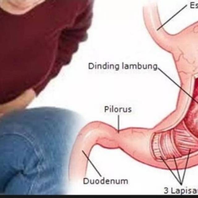 Obat Herbal Khusus Lambung Mucosafit Naturindo