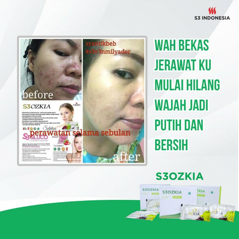 OZKIA S3 INDONESIA/ S3OZKIA