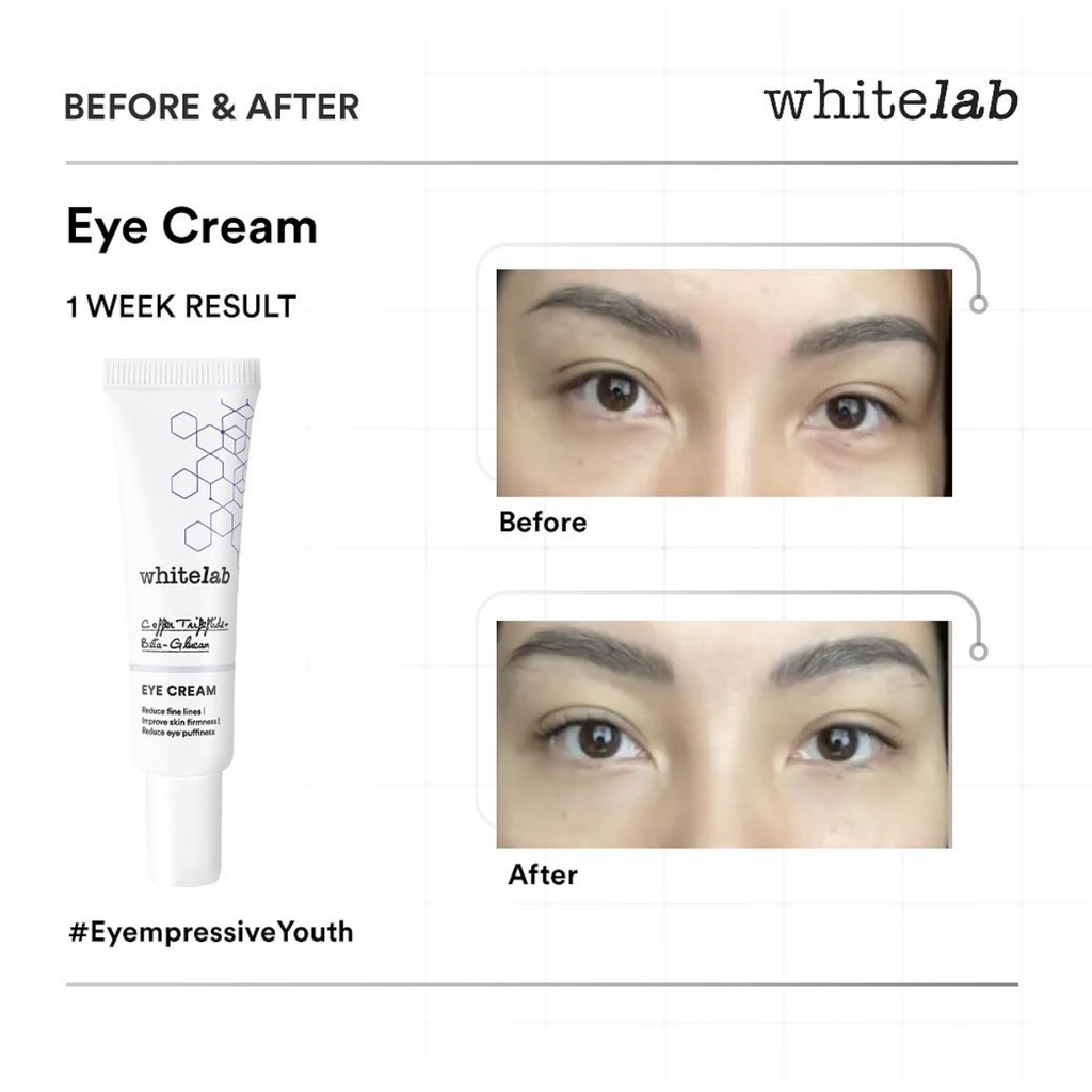 Whitelab Eye Cream 10ml