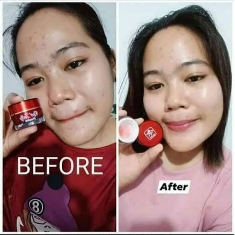 RED JELLY KRIM PENGHILANG JERAWAT MEMBUAT KUKIT BERSIH CERAH GLOWING ORIGINAL BPOM