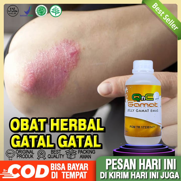 Obat Penyakit Gatal Gatal, alergi, Eksim, Gatal Ruam Kemerahan - Qnc Jelly Gamat 100% Original