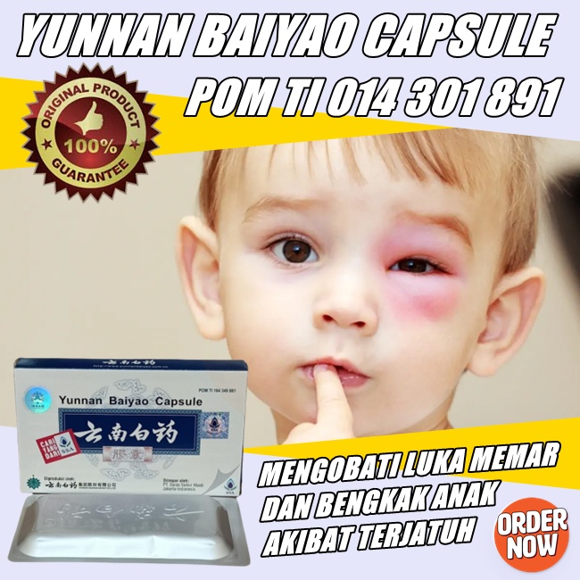 Obat herbal memar dan lebam untuk anak dan dewasa obat patah tulang cina yunan baiyao capsule BPOM