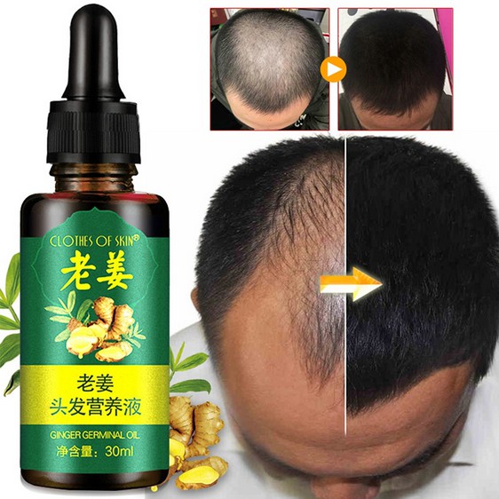 ORIGINAL Penumbuh Rambut Anti Rontok Obat kebotakan Cairan Nutrisi Rambut Jahe