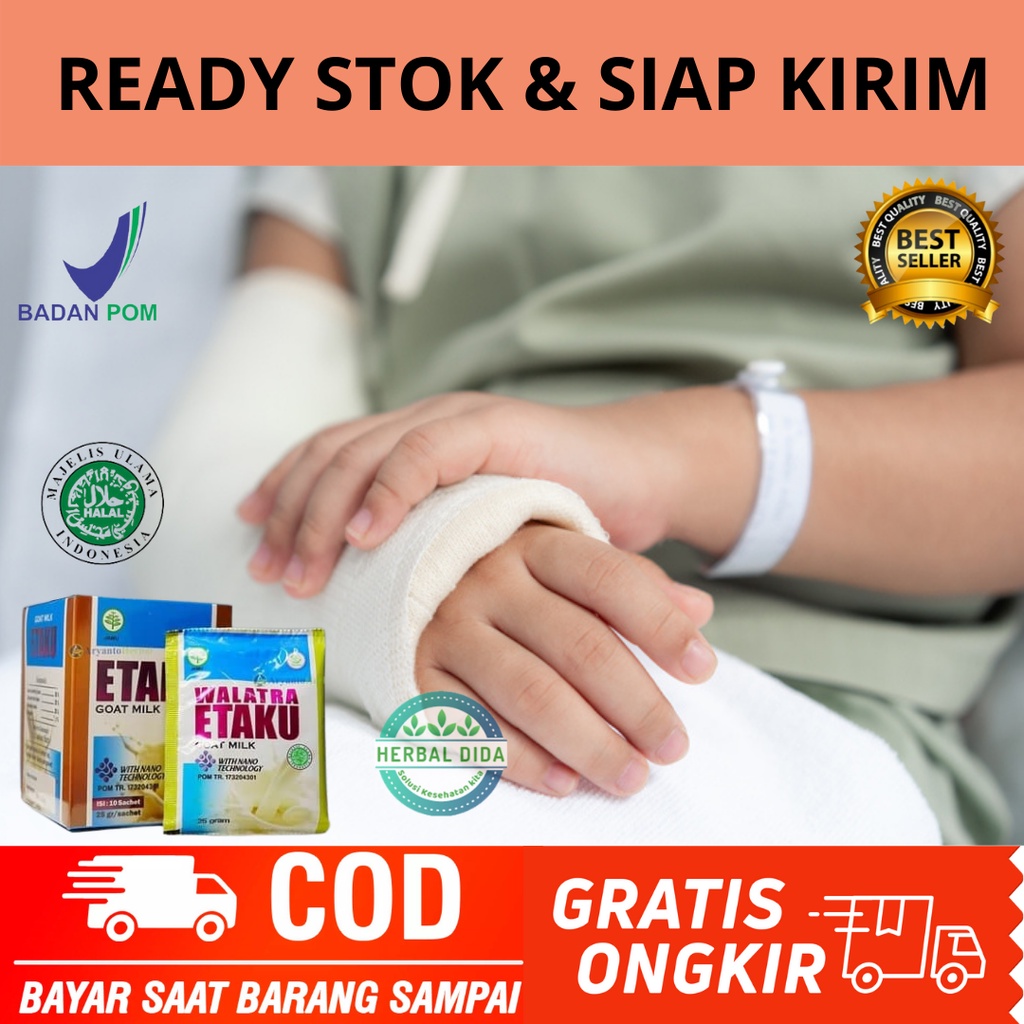 Obat Patah Tulang Dan Retak, Obat Patah Tulang / Retak, Obat Patah Tulang Kaki, Obat Herbal Pemuliha