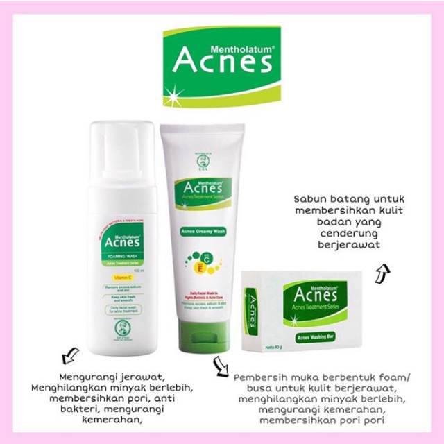 Jual ACNES TREATMENT SERIES | Shopee Indonesia