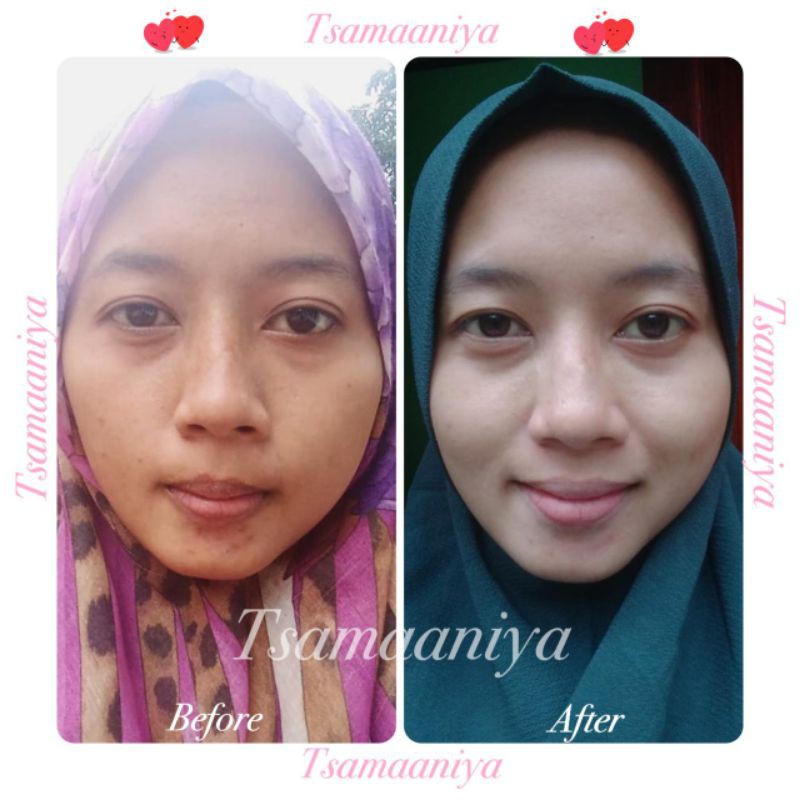 TSAMAANIYA Skincare Bpom Perawatan Wajah PAKET ALLSKIN TYPE 15gr-4