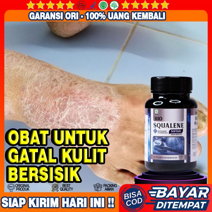 Obat Gatal Kulit Kering Bersisik - Obat Selangkangan Kering Bersisik - Obat Kulit Tangan Bersisik - 