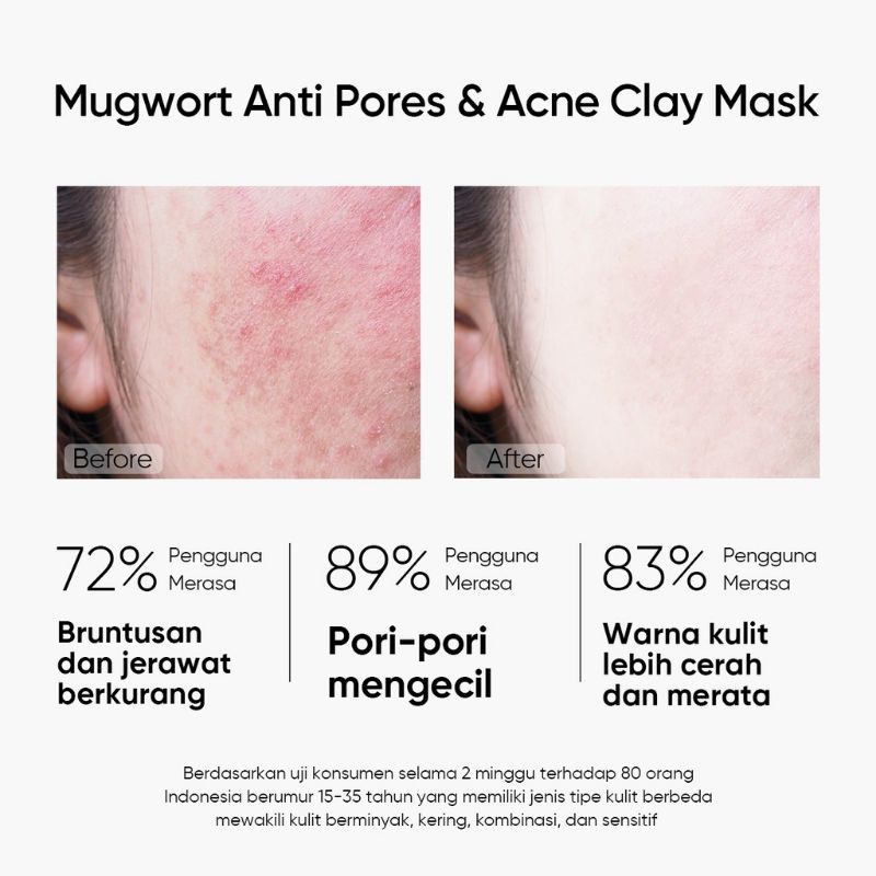[BPOM]SKINTIFIC Mugwort anti pores &amp; acne clay mask