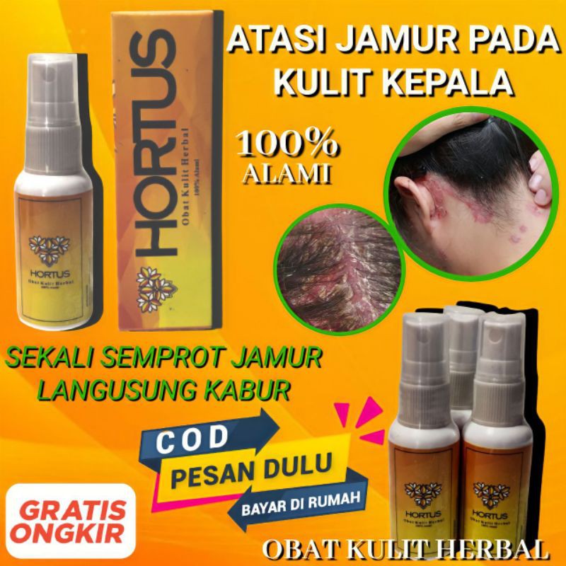Obat Kulit Ampuh Atasi Jamur Kulit Kepala Herbal Luka Diabetes Obat kulit Gatal eksim herpes luka
