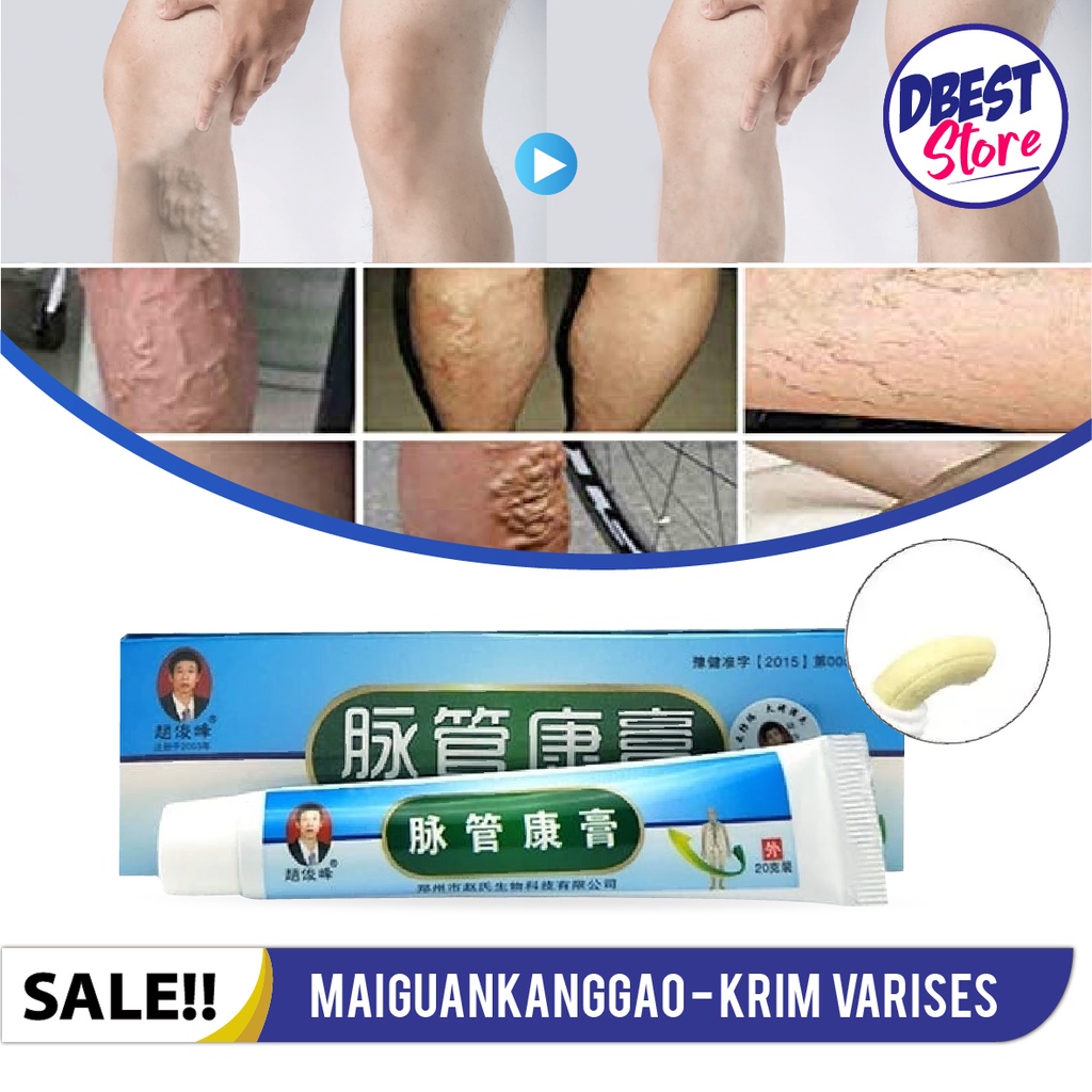 ORIGINAL SALEP OBAT KAKI VARISES PALING AMPUH ORIGINAL DAN PEGAL - PEGAL CREAM KRIM FARISES